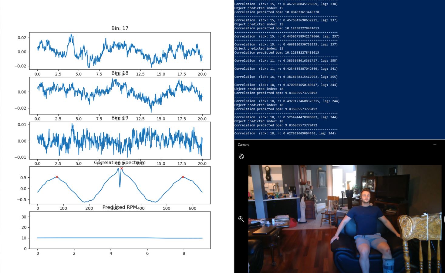 mmWave 60GHz Radar Vital Sign Detection